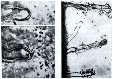 Рис. 148. Скопления клубеньковых бактерий вокруг корневых волосков. Стрелкой показано движение клеток клубеньковых бактерий к вершине корневого волоска клевера