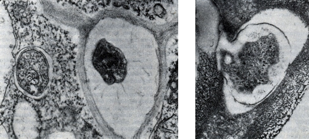 Рис. 156. Клетки клубеньковых бактерий в межклеточном пространстве (с лева, по Д. Джордану) и в момент входа из межклеточного пространства в клетку растения (справа). Увел. X 60 000
