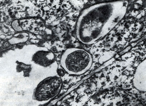 Рис. 157. Выход клубеньковых бактерий в ткань корня из везикулоподобных образований инфекционных нитей (по Гудчильду и Бергерсену)