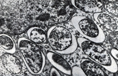 Рис. 160. Клетки клубеньковых бактерий вокруг ядра растительной клетки клубеньков вики. Увел. X 20 000