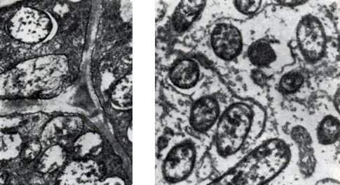 Рис. 162. Бактероидная ткань в период активного функционирования клубеньков клевера (слева - увел. X 10 000) и вики посевной (справа - увел X 6000).	
