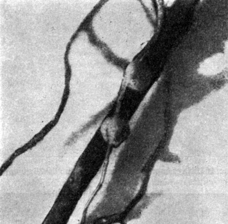 Рис. 170. Клубеньки на корнях вейника лесного (по И. Л. Клевенской)