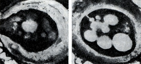 Рис. 175. Цисты азотобактера (по Й. Чану и др.). Зрелая циста, наполненная гранулами жира и окруженная толстой плотной оболочкой (справа), и прорастающая циста (растущая молодая клетка разрывает оболочку цисты - слева). Увел. X 35 000