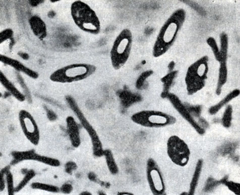 Рис. 178. Клетки Clostridium pasteurianum со спорами. Увел. X 3500 (по В. И. Дуде)