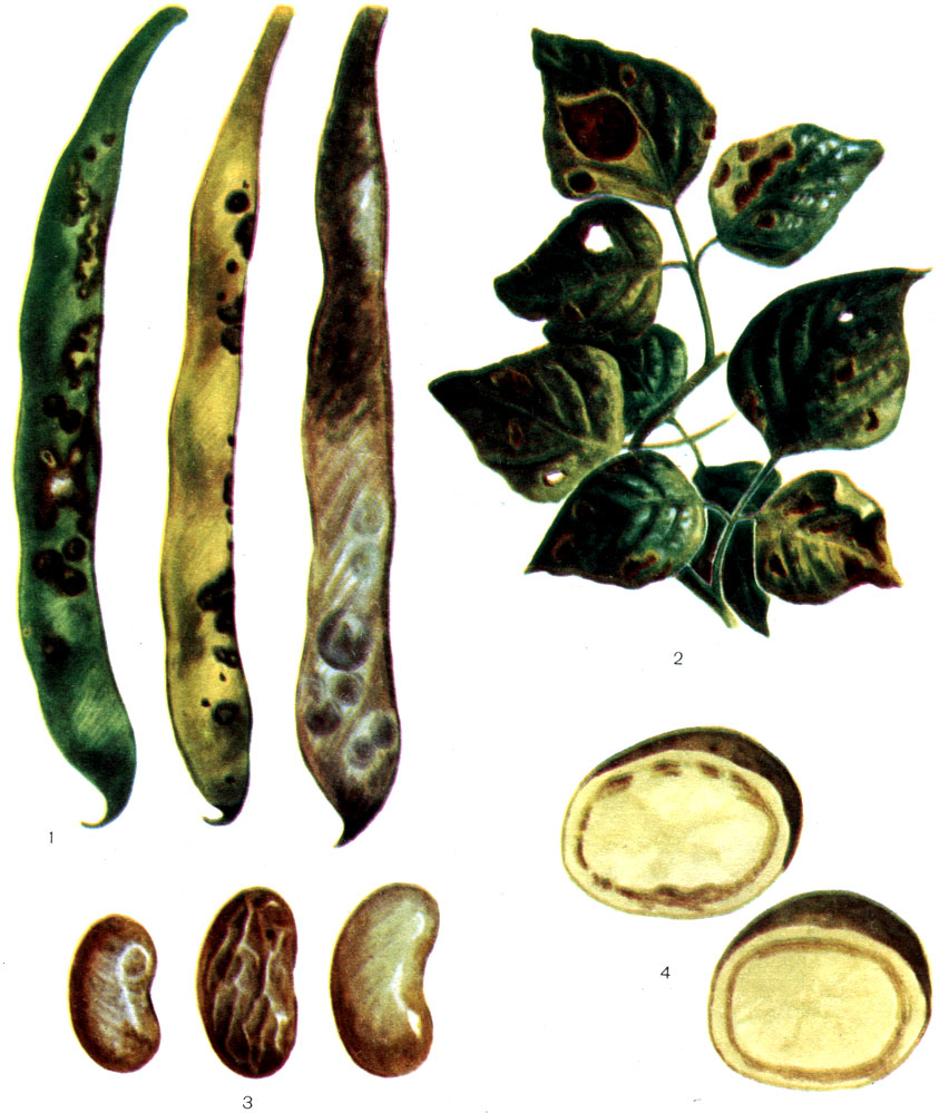 Таблица 48. Бурый бактериоз фасоли (1 - 3) и кольцевая гниль клубней картофеля: 1 - больные стручки; 2 - больные листья; 3 - больные семена; 4 - разрез клубня, пораженного кольцевой гнилью