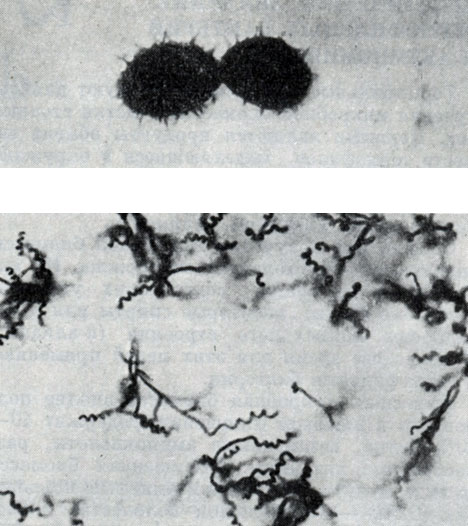Рис. 192. Термофильный актиномицет Actinomyces diastaticus, штамм 7. Вверху - споры с шиповидной поверхностью (увел. X 10 000); внизу - форма спороносцев (увел. X 900)