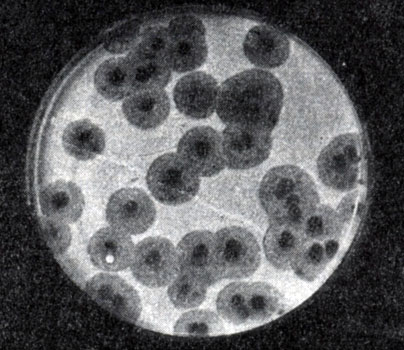 Рис. 217. Негативные колонии актинофага, окруженные ореолом угнетенного роста тест-культуры. Увел. 10 : 8