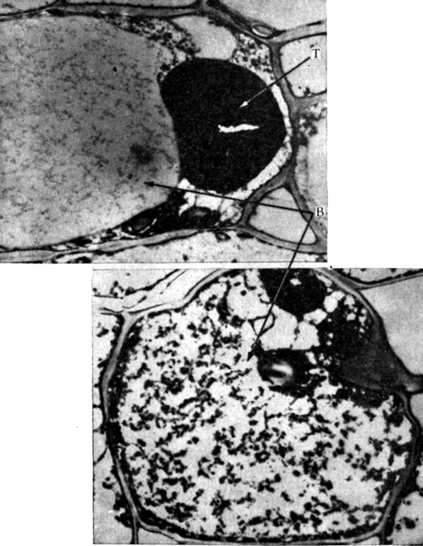 . 13.4.       Mimosa pudica   ()    (). B -  ; T - .    ,           ;          . X8000.     ,  OsO4. (Toriyama. 1971. Cytologia, 36, 359-395.)